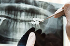 Como eu sei se preciso de uma cirurgia Ortogntica?